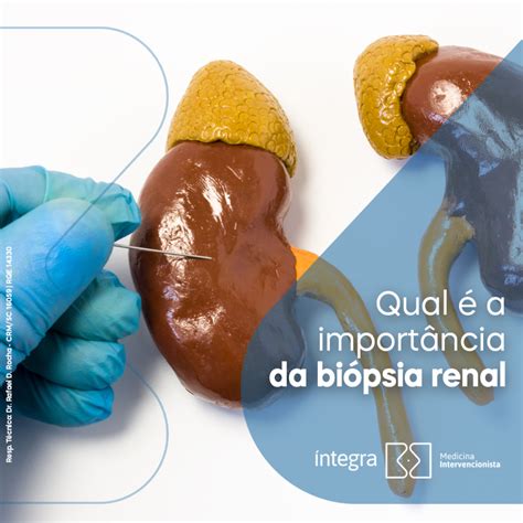 Qual é a importância da biópsia renal Dica Médica