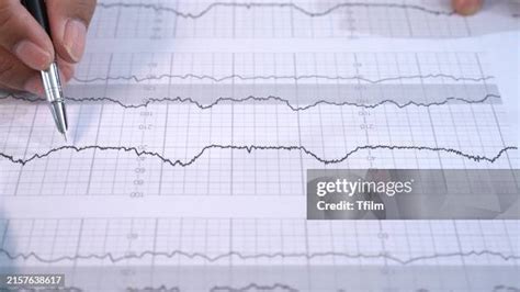 44 Ecg Graph Paper Stock Photos High Res Pictures And Images Getty