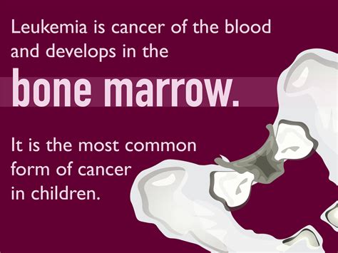 Pediatric Leukemia Symptoms and Signs | Dana-Farber Cancer Institute