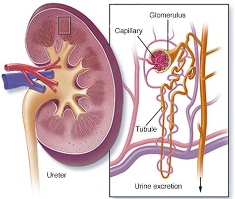 Nephrotic Syndrome - Causes, Signs, Symptoms, Diagnosis & Treatment