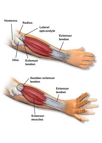 Archway Orthopedics