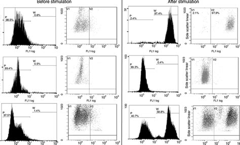 Flow Cytometry Dihydrorhodamine Test Done For Functional Assessment Of