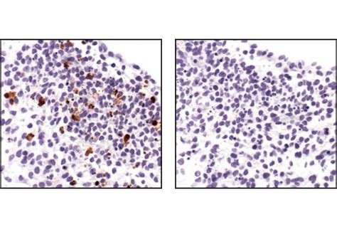 Apoptosis Marker SignalStain Cleaved Caspase 3 Asp175 IHC Detection