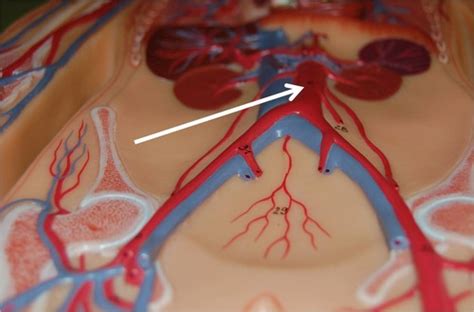 Bio 216 Practical 1 Cardiac Vessels Arteries Abdomen Pelvis