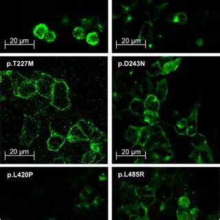 Localization Of Wild Type And Mutated NaCT Proteins Immunofluorescence