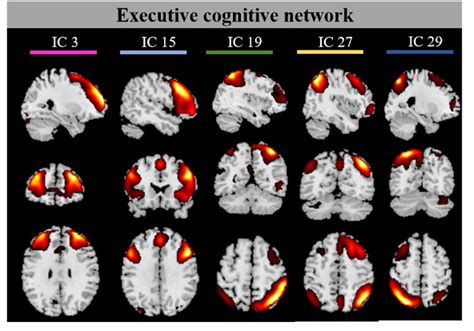 The Five Independent Components Of Executive Control Network Identified Download Scientific