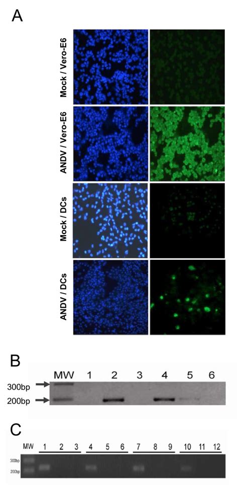 Detection Of ANDV Infection Of Primary Human Dendritic Cells A Vero