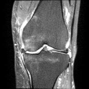 Orthodx Left Knee Pain In Older Woman Clinical Advisor