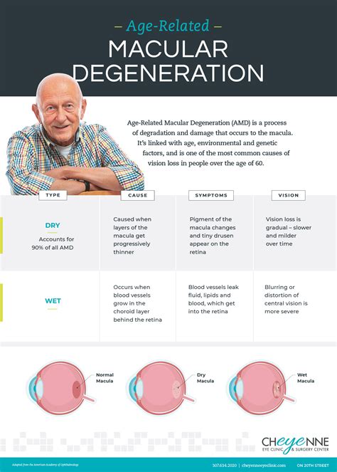 Dry vs. Wet Age-Related Macular Degeneration - Cheyenne Eye Clinic