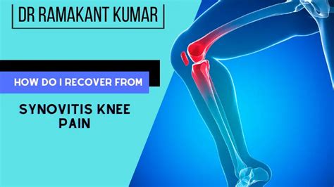 How Do I Recover From Synovitis Knee Pain? 5 Methods