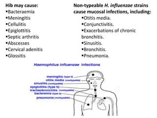 Haemophilus Influenzae PPT