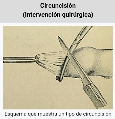 Para qué se inventó la circuncisión Quora