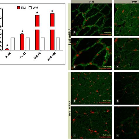 Immunoexpression Of Sox And Rod In Red And White Skeletal Muscle