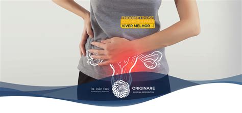 Conheça os tipos de endometriose Dr João Dias