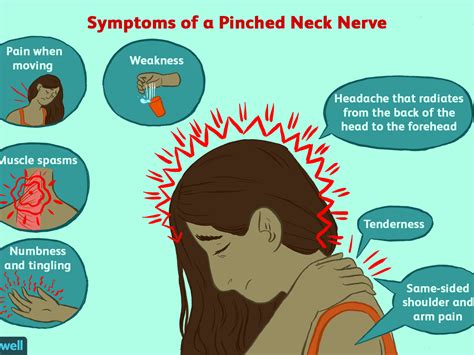 Pinched Nerve In Shoulder Pinched Nerve In Shoulder