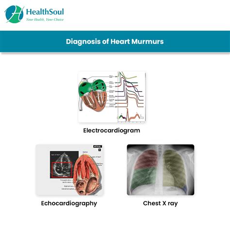 Heart Murmur: Symptoms and Causes – Healthsoul