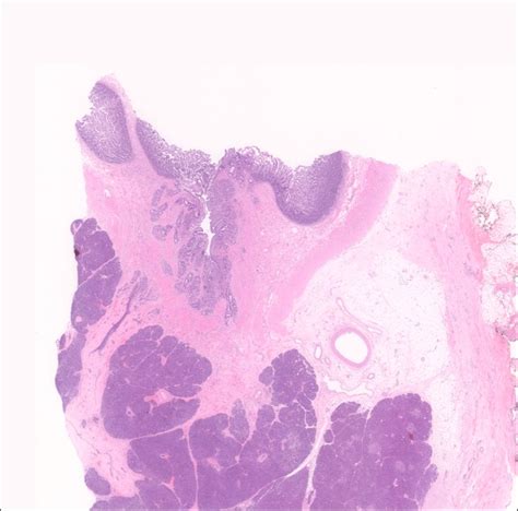 Ampulla – Normal Histology – NUS Pathweb :: NUS Pathweb