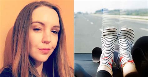 Woman Who Lost Her Forehead Warns People Not To Put Their Feet On The