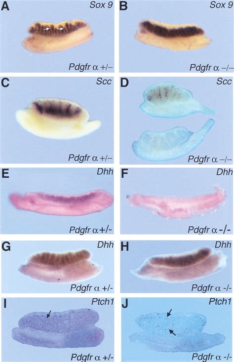 Pdgfr α Mediates Testis Cord Organization And Fetal Leydig Cell