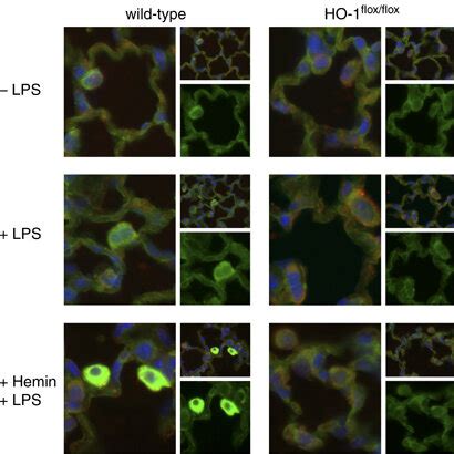 Immunofluorescence For Heme Oxygenase 1 HO 1 Expression In The Lungs