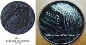 BCYE Agar Composition Principle Preparation Results Uses