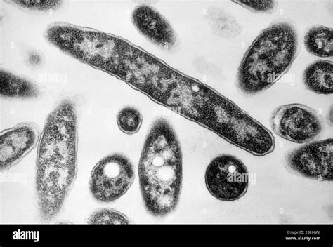 Bacterial Cell Under Electron Microscope