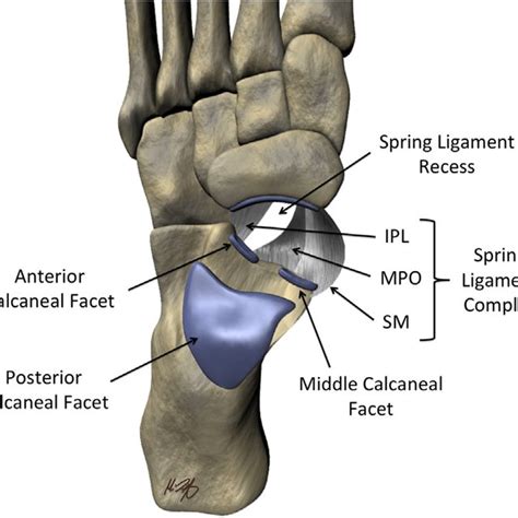 Tenosynovitis Of The Fhl Tendon At The Master Knot Of Henry Sagittal