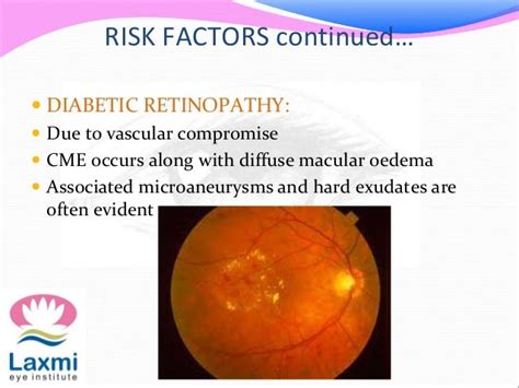 Cystoid macular oedema