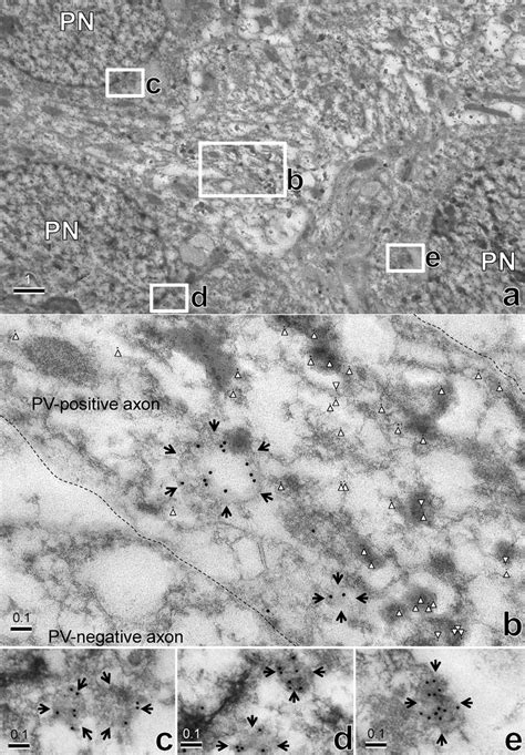 Electron micrographs of pyramidal neurons and axons in the pyramidal ... 