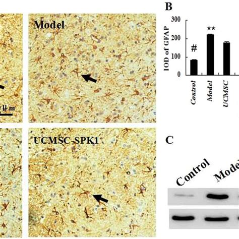 The Expression Of Gfap In The Spinal Cords A B Contrasting To The