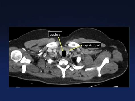 Cross Sectional Anatomy Of The Body Mdct Atlas Tomografía Estudio