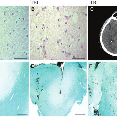 Overview of tissue morphology and myelin staining. Hematoxylin and ...