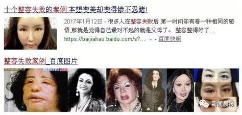 整容有風險！韓國一家醫院，20名顧客做了整容手術後，集體患上了敗血症！ 每日頭條