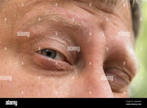 The Blond Man Narrowed His Eyes Close Up Stock Photo Alamy