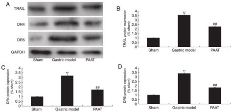 Paat Suppresses Trail Dr4 And Dr5 Protein Expression In Rats With