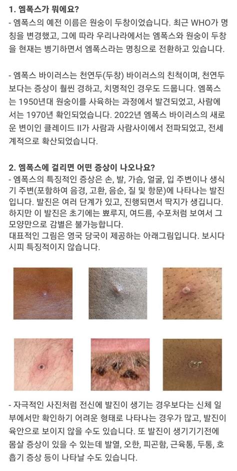 유용한 정보 저장계 On Twitter 예방의학과 전문의가 설명하는 엠폭스원숭이두창 관련 정보 12