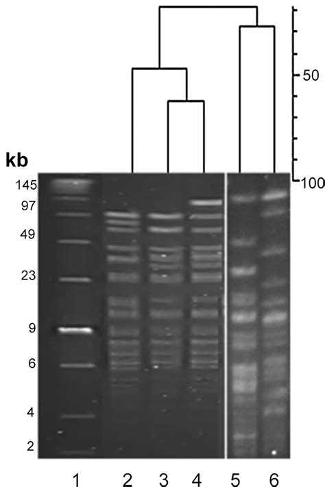 PFGE of B. breve isolates from triplet set A. PFGE macro-restriction ...