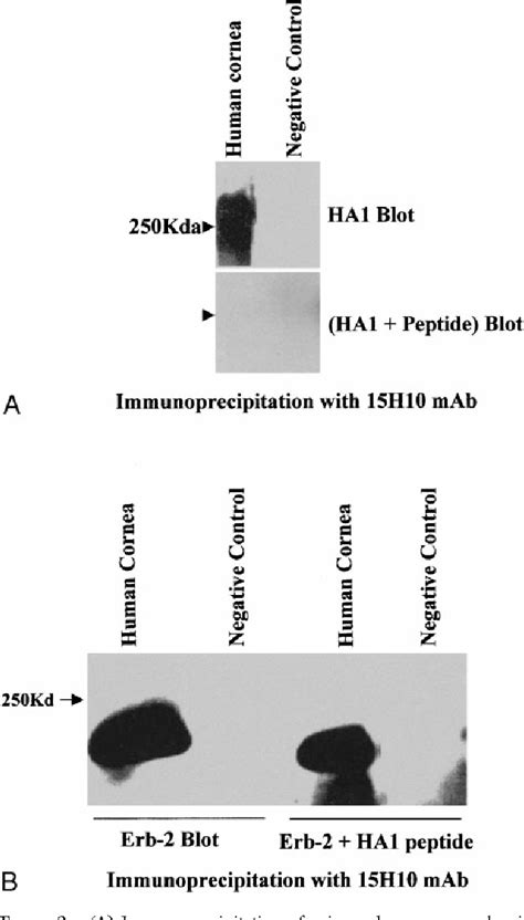 Figure From Detection Of Sialomucin Complex Muc In Human Ocular