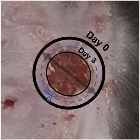 Photograph showing a full thickness skin wound at day 3 following ...