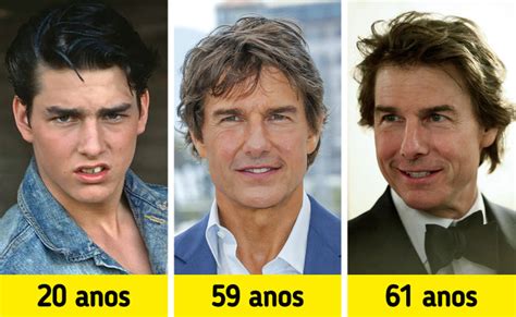 Ele precisa de cirurgia fãs pedem que Tom Cruise faça procedimentos