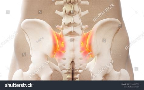 3d Rendered Illustration Painful Sacroiliac Joint Stock Illustration