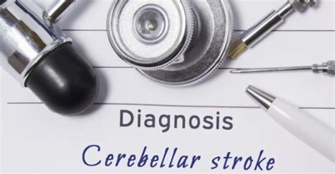 Cerebellar Stroke: Symptoms, Effects, and Recovery