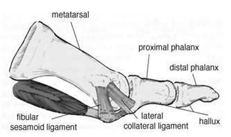 Lean 3 Lecture 49 MTP joint Flashcards | Quizlet