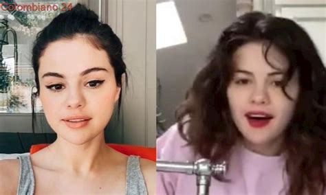 Selena Gómez Mostró Uno De Los Estragos Que Deja El Lupus En Su Cuerpo