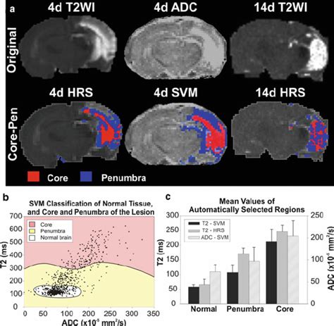 2 Lesion Core And Penumbra Detection By HRS And SVM A HRS Detected