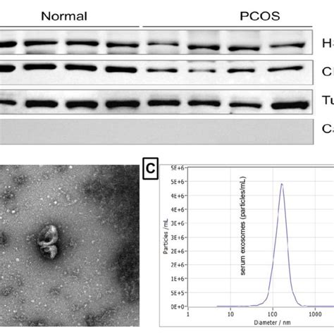 Characterization Of Exosomes Derived From Human Serum A Western Blot