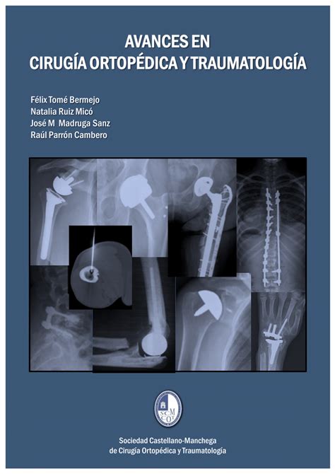 Avances En Cirugía Ortopédica Y Traumatología Download Scientific Diagram