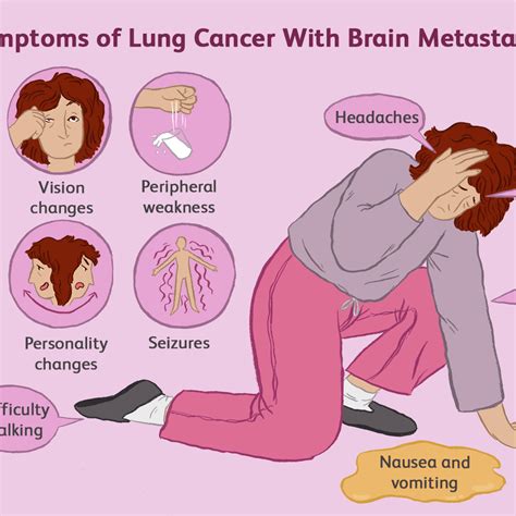 Lung Cancer Radiation Therapy Success Rate - All About Radiation