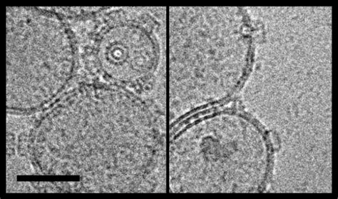 Erya Plyb Pores On Large Unilamellar Vesicles Cryo Em Of Erya Plyb Download Scientific Diagram