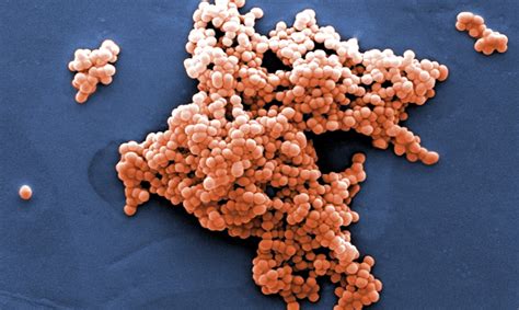 Beta Hemolytic Strep Osteoarticular Infections Increasing